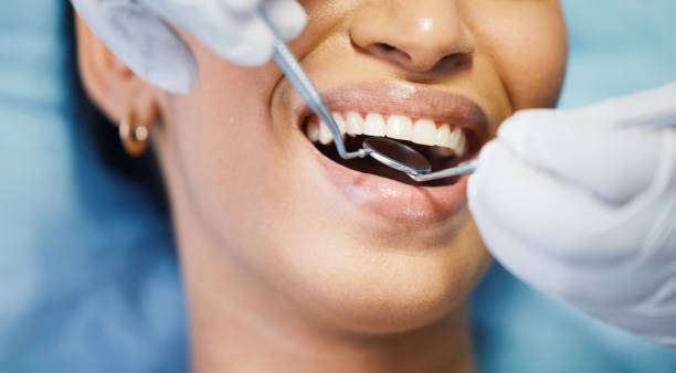Best Emergency Tooth Extraction in Wamac, IN